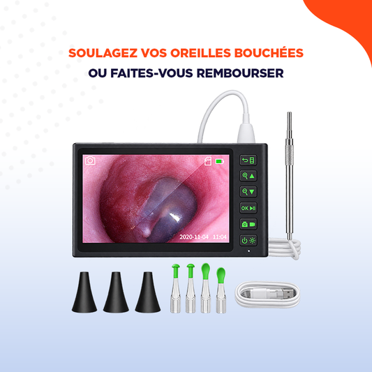 EarScope | Caméra d'oreille HD pour un nettoyage sûr et clair